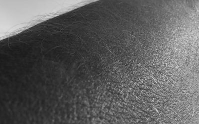 Shitstorm: Hat Angela Merkel haarige Arme? Paul Watzlawick gilt auch im Internet